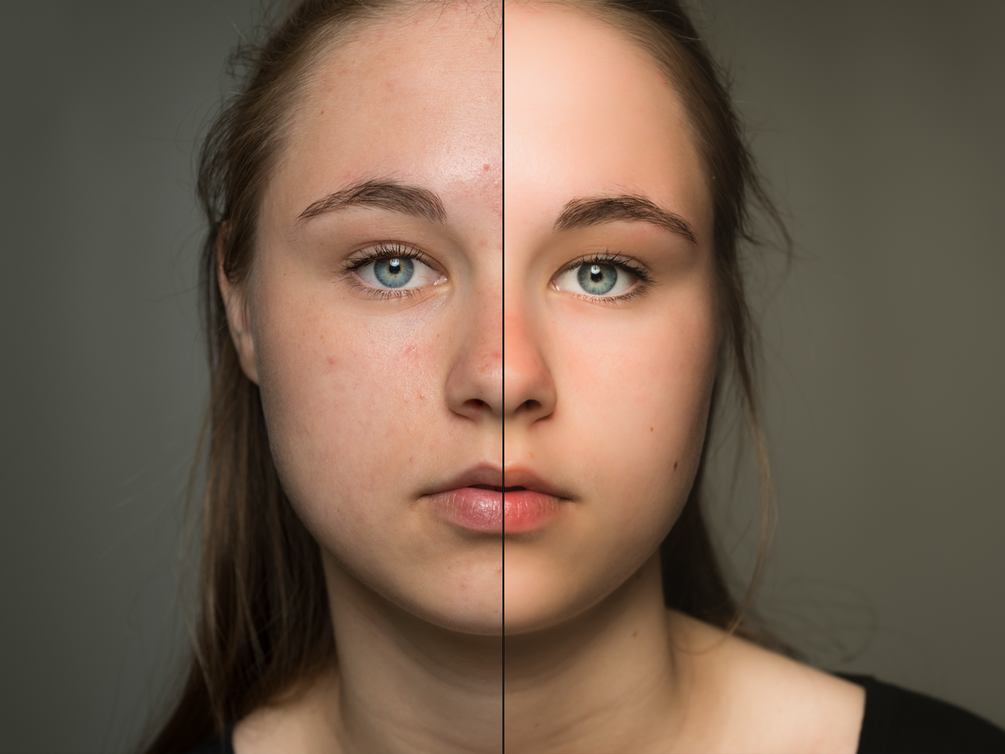 How to Use Lightroom: Fix Wrinkles, Pimples, and Smooth the Skin